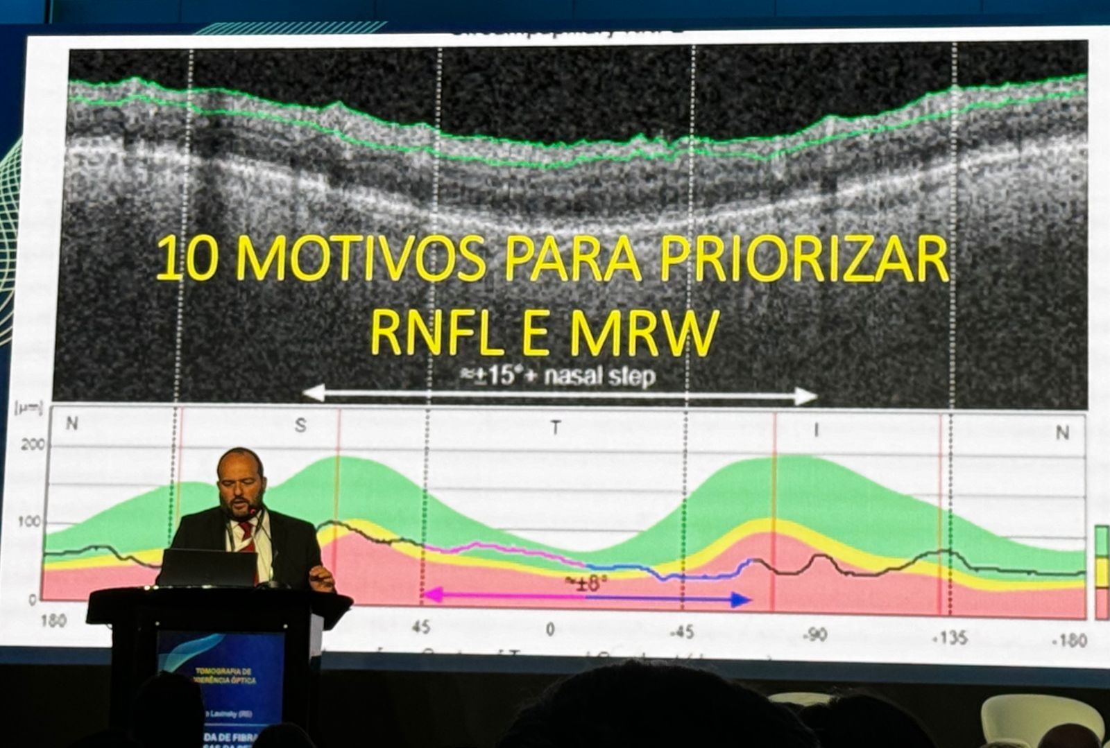 Dr. Fábio Lavinsky participa do Glaucoma Summit, em Curitiba