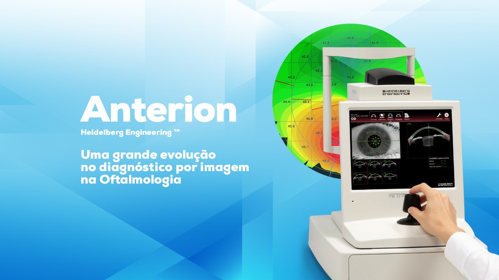 Anterion: A revolução em diagnóstico por imagem na oftalmologia